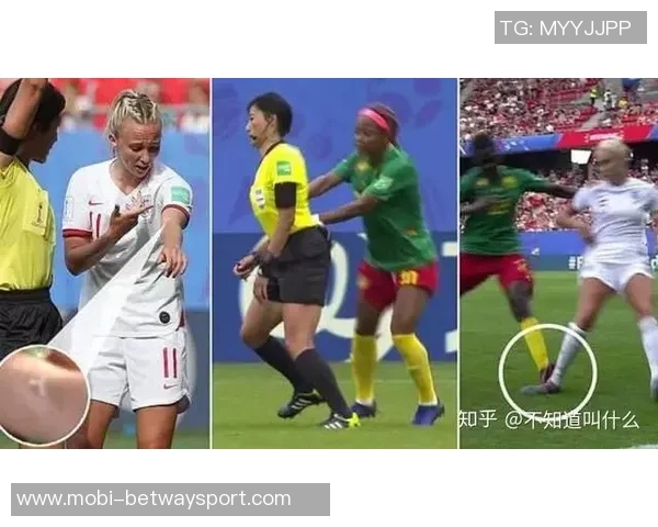 马竞女足球员梅迪纳遭遇严重撞击一度失去意识现已脱离生命危险